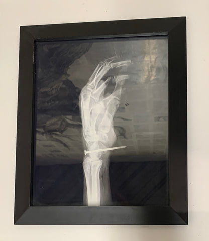 X-ray of Jesus